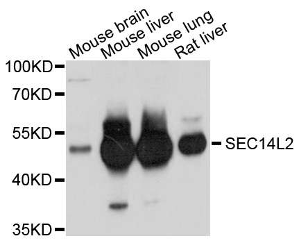 SEC14L2 Antibody - Western blot analysis of extracts of various cell lines, using SEC14L2 antibody at 1:1000 dilution. The secondary antibody used was an HRP Goat Anti-Rabbit IgG (H+L) at 1:10000 dilution. Lysates were loaded 25ug per lane and 3% nonfat dry milk in TBST was used for blocking. An ECL Kit was used for detection and the exposure time was 10s.