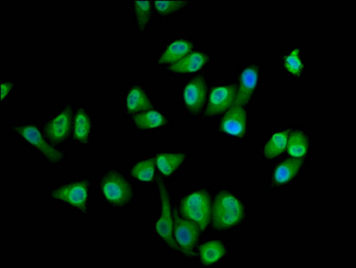 SEC14L2 Antibody - Immunofluorescence staining of Hela cells diluted at 1:133, counter-stained with DAPI. The cells were fixed in 4% formaldehyde, permeabilized using 0.2% Triton X-100 and blocked in 10% normal Goat Serum. The cells were then incubated with the antibody overnight at 4°C.The Secondary antibody was Alexa Fluor 488-congugated AffiniPure Goat Anti-Rabbit IgG (H+L).