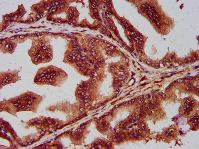 SEC14L2 Antibody - Immunohistochemistry Dilution at 1:400 and staining in paraffin-embedded human prostate tissue performed on a Leica BondTM system. After dewaxing and hydration, antigen retrieval was mediated by high pressure in a citrate buffer (pH 6.0). Section was blocked with 10% normal Goat serum 30min at RT. Then primary antibody (1% BSA) was incubated at 4°C overnight. The primary is detected by a biotinylated Secondary antibody and visualized using an HRP conjugated SP system.