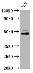 SEC14L2 Antibody - Western Blot Positive WB detected in: PC3 whole cell lysate All Lanes: SEC14L2 antibody at 4.28µg/ml Secondary Goat polyclonal to rabbit IgG at 1/50000 dilution Predicted band size: 47, 45, 37 KDa Observed band size: 47 KDa