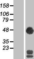 SEC14L2 Protein - Western validation with an anti-DDK antibody * L: Control HEK293 lysate R: Over-expression lysate
