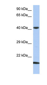 SEC14L4 Antibody - SEC14L4 antibody Western blot of OVCAR-3 cell lysate. This image was taken for the unconjugated form of this product. Other forms have not been tested.