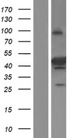 SEC14L4 Protein - Western validation with an anti-DDK antibody * L: Control HEK293 lysate R: Over-expression lysate