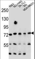 SEC14L5 Antibody - SEC14L5 Antibody western blot of K562,NCI-H460,ZR-75-1,293,MDA-MB231 cell line lysates (35 ug/lane). The SEC14L5 antibody detected the SEC14L5 protein (arrow).