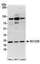 SEC22B Antibody - Detection of human SEC22B by western blot. Samples: Whole cell lysate (50 µg) from HeLa, HEK293T, and Jurkat cells prepared using NETN lysis buffer. Antibodies: Affinity purified rabbit anti-SEC22B antibody used for WB at 1 µg/ml. Detection: Chemiluminescence with an exposure time of 30 seconds.