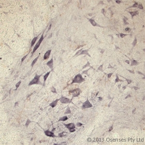 SEC22B Antibody - Rabbit antibody to SEC22B (2-50). IHC on rat spinal cord using Rabbit antibody to SEC22Bat a concentration of 30 ug/ml. Pre-absorption of the antibody with the immunizing peptide completely abolishes the immunostaining (not shown).