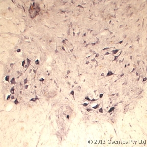 SEC22B Antibody - Rabbit antibody to SEC22B (2-50). IHC on rat spinal cord using Rabbit antibody to SEC22Bat a concentration of 30 ug/ml. Pre-absorption of the antibody with the immunizing peptide completely abolishes the immunostaining (not shown).