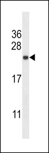 SEC22B Antibody - SEC22B Antibody western blot of HeLa cell line lysates (35 ug/lane). The SEC22B antibody detected the SEC22B protein (arrow).