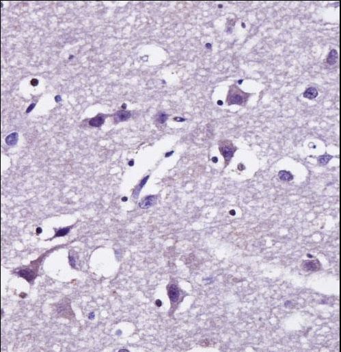 SEC22B Antibody - SEC22B Antibody immunohistochemistry of formalin-fixed and paraffin-embedded human brain tissue followed by peroxidase-conjugated secondary antibody and DAB staining.