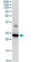 SEC22B Antibody - SEC22B monoclonal antibody (M03), clone 5A10. Western blot of SEC22B expression in HeLa.