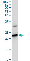 SEC22B Antibody - SEC22B monoclonal antibody (M03), clone 5A10. Western blot of SEC22B expression in PC-12.
