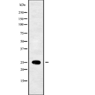 SEC22B Antibody - Western blot analysis SEC22B using 293 whole cells lysates