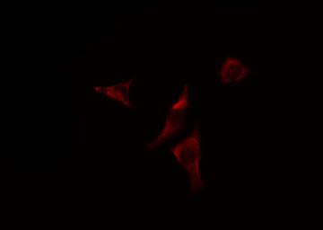 SEC22B Antibody - Staining HeLa cells by IF/ICC. The samples were fixed with PFA and permeabilized in 0.1% Triton X-100, then blocked in 10% serum for 45 min at 25°C. The primary antibody was diluted at 1:200 and incubated with the sample for 1 hour at 37°C. An Alexa Fluor 594 conjugated goat anti-rabbit IgG (H+L) antibody, diluted at 1/600, was used as secondary antibody.