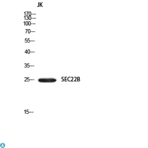 SEC22B Antibody - Western Blot (WB) analysis of JK using SEC22B antibody.