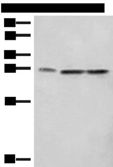 SEC22B Antibody - Western blot analysis of A172 LOVO and Hela cell lysates  using SEC22B Polyclonal Antibody at dilution of 1:450