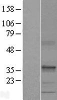 SEC22C Protein - Western validation with an anti-DDK antibody * L: Control HEK293 lysate R: Over-expression lysate