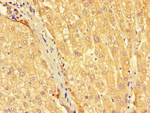 SEC22L2 / SEC22A Antibody - Immunohistochemistry of paraffin-embedded human liver tissue using SEC22A Antibody at dilution of 1:100