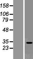 SEC22L2 / SEC22A Protein - Western validation with an anti-DDK antibody * L: Control HEK293 lysate R: Over-expression lysate