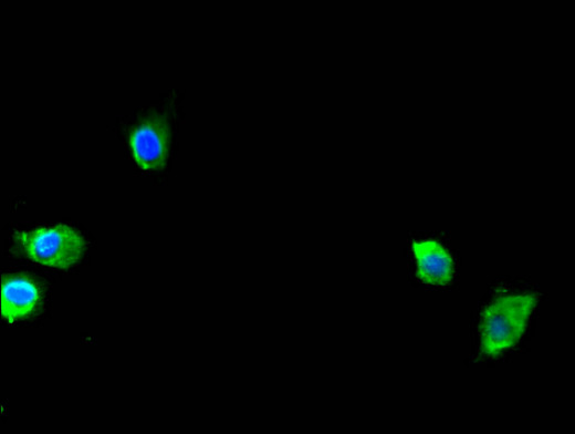 SEC23A / COP II Antibody - Immunofluorescent analysis of Hela cells using SEC23A Antibody at a dilution of 1:100 and Alexa Fluor 488-congugated AffiniPure Goat Anti-Rabbit IgG(H+L)