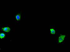 SEC23A / COP II Antibody - Immunofluorescent analysis of Hela cells using SEC23A Antibody at a dilution of 1:100 and Alexa Fluor 488-congugated AffiniPure Goat Anti-Rabbit IgG(H+L)