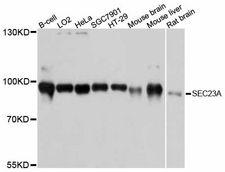 SEC23A / COP II Antibody - Western blot analysis of extracts of various cell lines, using SEC23A antibody at 1:3000 dilution. The secondary antibody used was an HRP Goat Anti-Rabbit IgG (H+L) at 1:10000 dilution. Lysates were loaded 25ug per lane and 3% nonfat dry milk in TBST was used for blocking. An ECL Kit was used for detection and the exposure time was 10s.