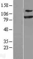 SEC23A / COP II Protein - Western validation with an anti-DDK antibody * L: Control HEK293 lysate R: Over-expression lysate