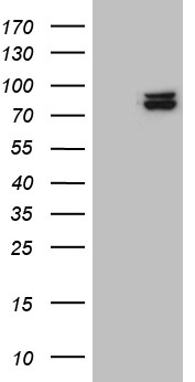 SEC23B Antibody - HEK293T cells were transfected with the pCMV6-ENTRY control. (Left lane) or pCMV6-ENTRY SEC23B. (Right lane) cDNA for 48 hrs and lysed. Equivalent amounts of cell lysates. (5 ug per lane) were separated by SDS-PAGE and immunoblotted with anti-SEC23B. (1:500)