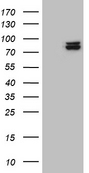 SEC23B Antibody - HEK293T cells were transfected with the pCMV6-ENTRY control. (Left lane) or pCMV6-ENTRY SEC23B. (Right lane) cDNA for 48 hrs and lysed. Equivalent amounts of cell lysates. (5 ug per lane) were separated by SDS-PAGE and immunoblotted with anti-SEC23B. (1:500)