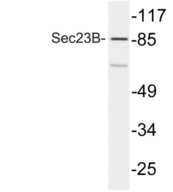 SEC23B Antibody - Western blot analysis of lysate from COLO205 cells, using Sec23B antibody.