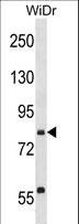 SEC23B Antibody - SEC23B Antibody western blot of WiDr cell line lysates (35 ug/lane). The SEC23B antibody detected the SEC23B protein (arrow).