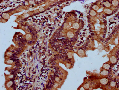 SEC23B Antibody - Immunohistochemistry Dilution at 1:300 and staining in paraffin-embedded human small intestine tissue performed on a Leica BondTM system. After dewaxing and hydration, antigen retrieval was mediated by high pressure in a citrate buffer (pH 6.0). Section was blocked with 10% normal Goat serum 30min at RT. Then primary antibody (1% BSA) was incubated at 4°C overnight. The primary is detected by a biotinylated Secondary antibody and visualized using an HRP conjugated SP system.