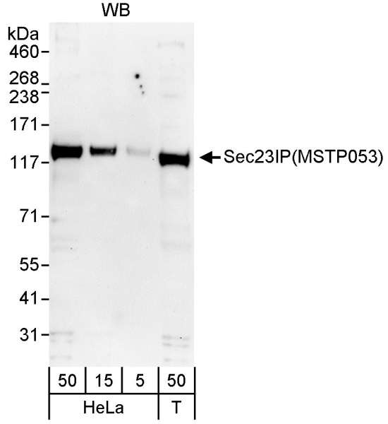SEC23IP / p125 Antibody - Detection of Human Sec23IP(MSTP053) by Western Blot. Samples: Whole cell lysate from HeLa (5, 15 and 50 ug) and 293T (T; 50 ug) cells. Antibody: Affinity purified rabbit anti-Sec23IP(MSTP053) antibody used for WB at 0.04 ug/ml. Detection: Chemiluminescence with exposure times of 3 minutes.
