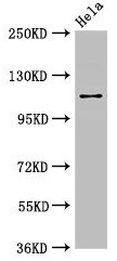 SEC23IP / p125 Antibody - Western Blot Positive WB detected in: Hela whole cell lysate All lanes: SEC23IP antibody at 2.7µg/ml Secondary Goat polyclonal to rabbit IgG at 1/50000 dilution Predicted band size: 112, 103 kDa Observed band size: 112 kDa