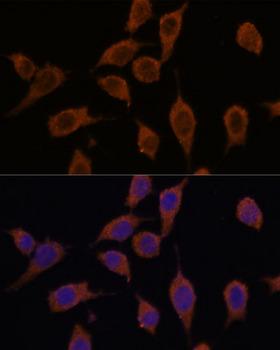 SEC23IP / p125 Antibody - Immunofluorescence analysis of L929 cells using SEC23IP Polyclonal Antibody at dilution of 1:100.Blue: DAPI for nuclear staining.