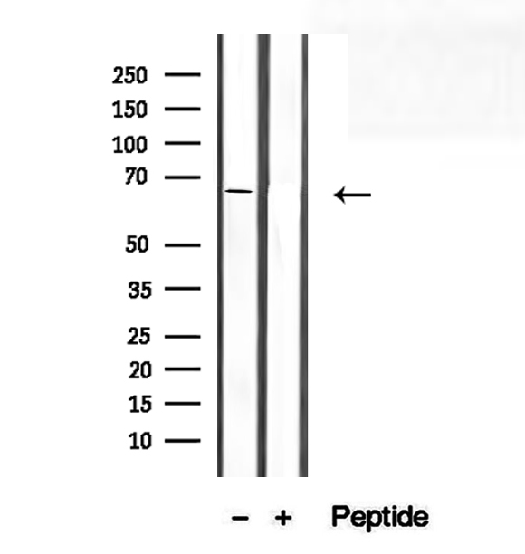 SEC24A Antibody - Western blot analysis of extracts of mouse skeletal muscle using SEC24A antibody.