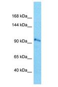 SEC24C Antibody - SEC24C antibody Western Blot of MCF7. Antibody dilution: 1 ug/ml.  This image was taken for the unconjugated form of this product. Other forms have not been tested.