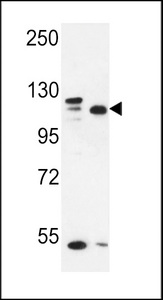 SEC24C Antibody - SEC24C Antibody western blot of MDA-MB435,MCF-7 cell line lysates (35 ug/lane). The SEC24C antibody detected the SEC24C protein (arrow).