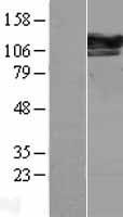 SEC24D Protein - Western validation with an anti-DDK antibody * L: Control HEK293 lysate R: Over-expression lysate