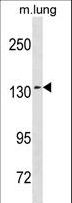 SEC31A / HSPC275 Antibody - SEC31A Antibody western blot of mouse lung tissue lysates (35 ug/lane). The SEC31A antibody detected the SEC31A protein (arrow).