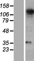 SEC31A / HSPC275 Protein - Western validation with an anti-DDK antibody * L: Control HEK293 lysate R: Over-expression lysate