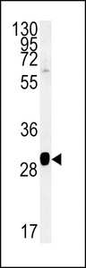 SEC31B Antibody - SC31B Antibody western blot of NCI-H460 cell line lysates (15 ug/lane). The SC31B antibody detected the SC31B protein (arrow).