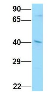 SEC61A1 / SEC61 Antibody - SEC61A1 / SEC61 antibody Western Blot of Human Placenta. Antibody Dilution: 1.0ug/ml. Antibody dilution: 1 ug/ml.  This image was taken for the unconjugated form of this product. Other forms have not been tested.