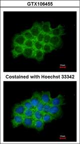 SEC61A1 / SEC61 Antibody - Immunofluorescence of methanol-fixed A431 using SEC61A1 antibody at 1:200 dilution.