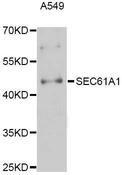 SEC61A1 / SEC61 Antibody - Western blot analysis of extracts of A-549 cells, using SEC61A1 Antibody at 1:3000 dilution. The secondary antibody used was an HRP Goat Anti-Rabbit IgG (H+L) at 1:10000 dilution. Lysates were loaded 25ug per lane and 3% nonfat dry milk in TBST was used for blocking. An ECL Kit was used for detection and the exposure time was 90s.