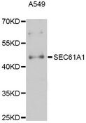 SEC61A1 / SEC61 Antibody - Western blot analysis of extracts of A-549 cells, using SEC61A1 Antibody at 1:3000 dilution. The secondary antibody used was an HRP Goat Anti-Rabbit IgG (H+L) at 1:10000 dilution. Lysates were loaded 25ug per lane and 3% nonfat dry milk in TBST was used for blocking. An ECL Kit was used for detection and the exposure time was 90s.
