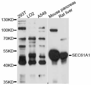 SEC61A1 / SEC61 Antibody - Western blot analysis of extracts of various cell lines, using SEC61A1 antibody at 1:3000 dilution. The secondary antibody used was an HRP Goat Anti-Rabbit IgG (H+L) at 1:10000 dilution. Lysates were loaded 25ug per lane and 3% nonfat dry milk in TBST was used for blocking. An ECL Kit was used for detection and the exposure time was 30s.