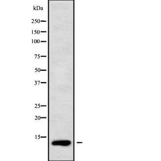 SEC61B Antibody - Western blot analysis SEC61B using COLO205 whole cells lysates