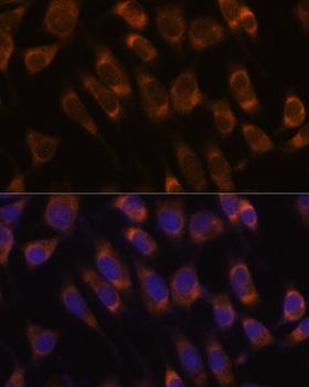 SEC61B Antibody - Immunofluorescence analysis of L929 cells using SEC61B Polyclonal Antibody at dilution of 1:100.Blue: DAPI for nuclear staining.