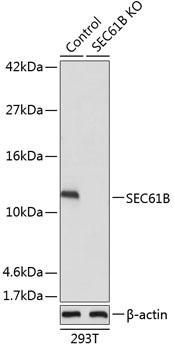 SEC61B Antibody - Western blot analysis of extracts from normal (control) and SEC61B knockout (KO) 293T cells using SEC61B Polyclonal Antibody at dilution of 1:1000.