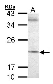 SEC61G Antibody - Sample (30 ug of whole cell lysate). A:293T. 12% SDS PAGE. SEC61G antibody diluted at 1:500.